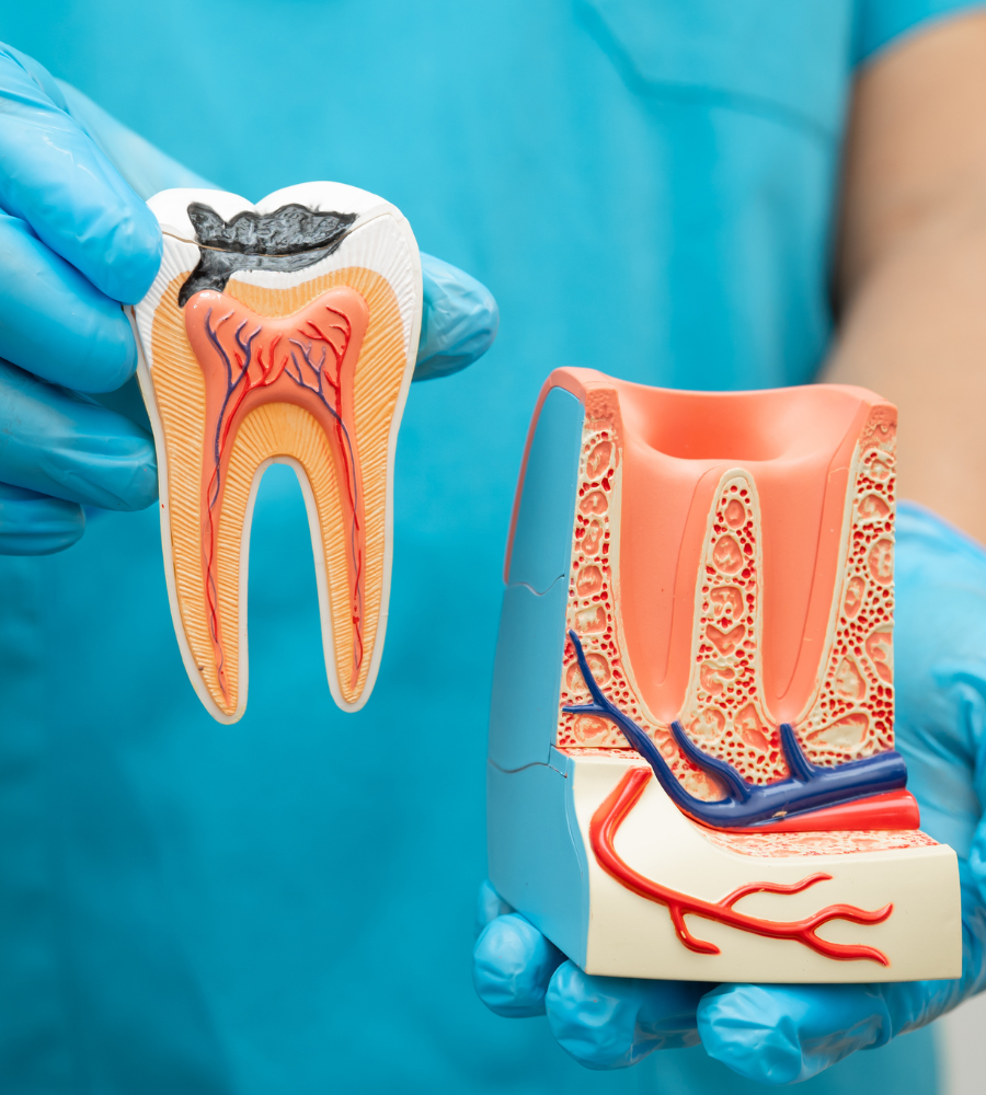 Root Canal Treatment Aftercare Image