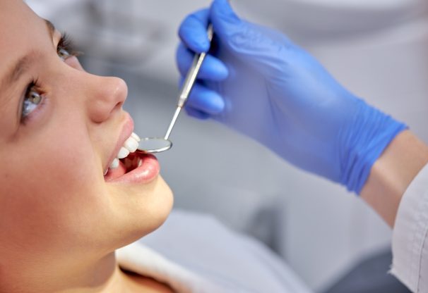 benefits-of-sealants-for-childrens-teeth-2-img