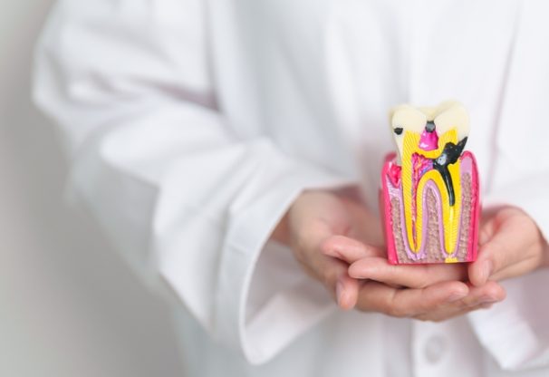 understanding-and-preventing-tooth-decay-img