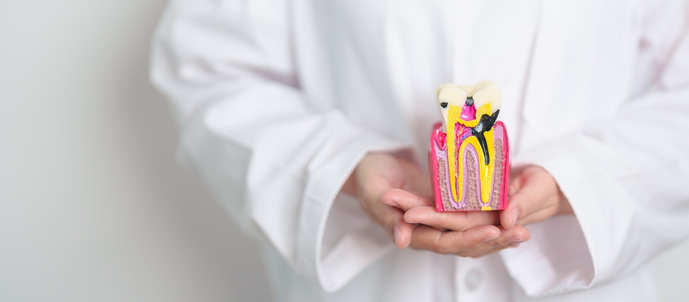 Understanding and Preventing Tooth Decay Image
